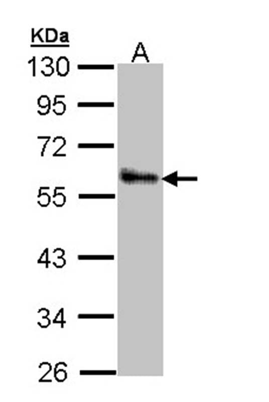 Sample (30 µg of whole cell lysate)  A431 10% SDS PAGE Primary antibody diluted at 1: 1000