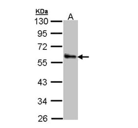 ZNF259 antibody from Signalway Antibody (22370) - Antibodies.com