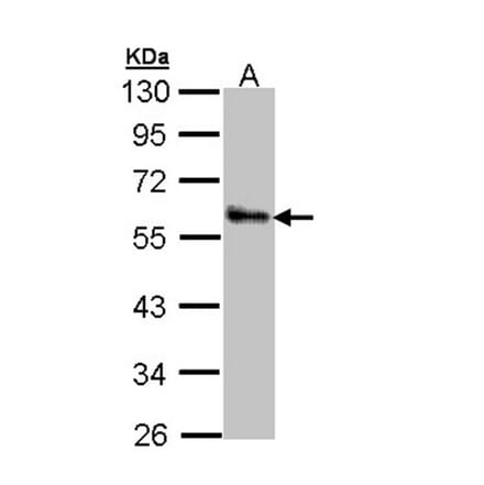 ZNF259 antibody from Signalway Antibody (22370) - Antibodies.com