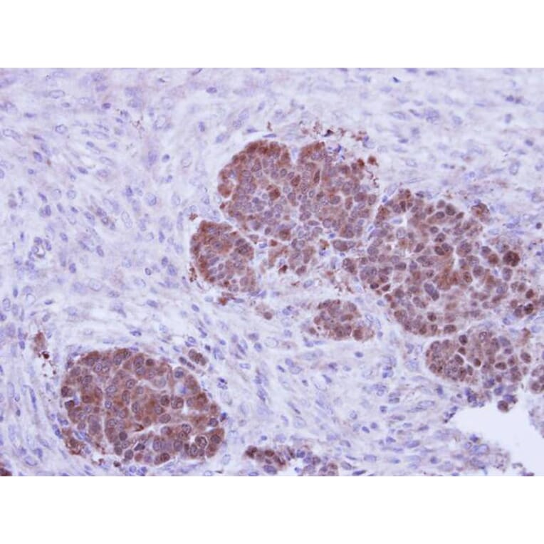 Immunohistochemistry - ZNF259 antibody from Signalway Antibody (22370) - Antibodies.com
