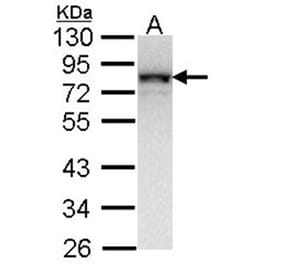 NDUFS1 antibody from Signalway Antibody (22417) - Antibodies.com