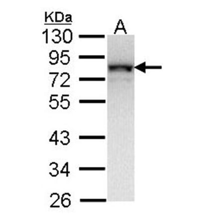 NDUFS1 antibody from Signalway Antibody (22417) - Antibodies.com