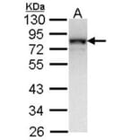 NDUFS1 antibody from Signalway Antibody (22417) - Antibodies.com