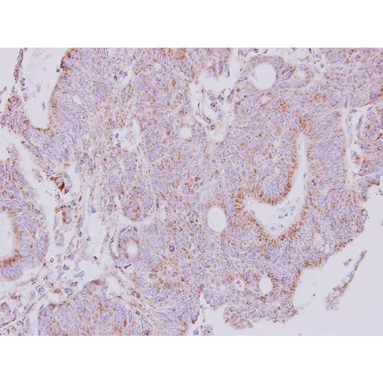 Immunohistochemistry - NDUFS1 antibody from Signalway Antibody (22417) - Antibodies.com