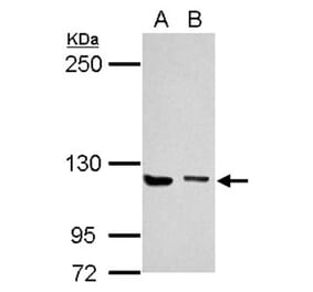 UNC13D antibody from Signalway Antibody (22449) - Antibodies.com