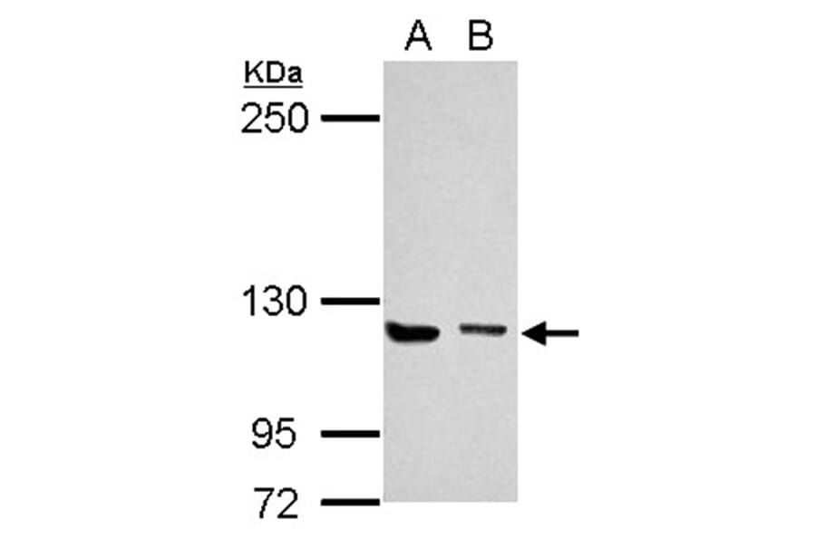 UNC13D antibody from Signalway Antibody (22449) - Antibodies.com
