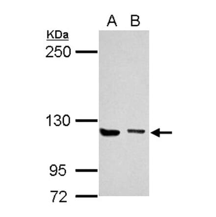 UNC13D antibody from Signalway Antibody (22449) - Antibodies.com
