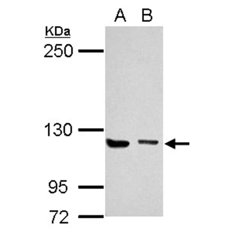 UNC13D antibody from Signalway Antibody (22449) - Antibodies.com