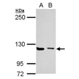 UNC13D antibody from Signalway Antibody (22449) - Antibodies.com