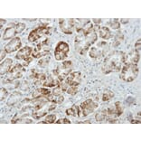 Immunohistochemistry - UNC13D antibody from Signalway Antibody (22449) - Antibodies.com