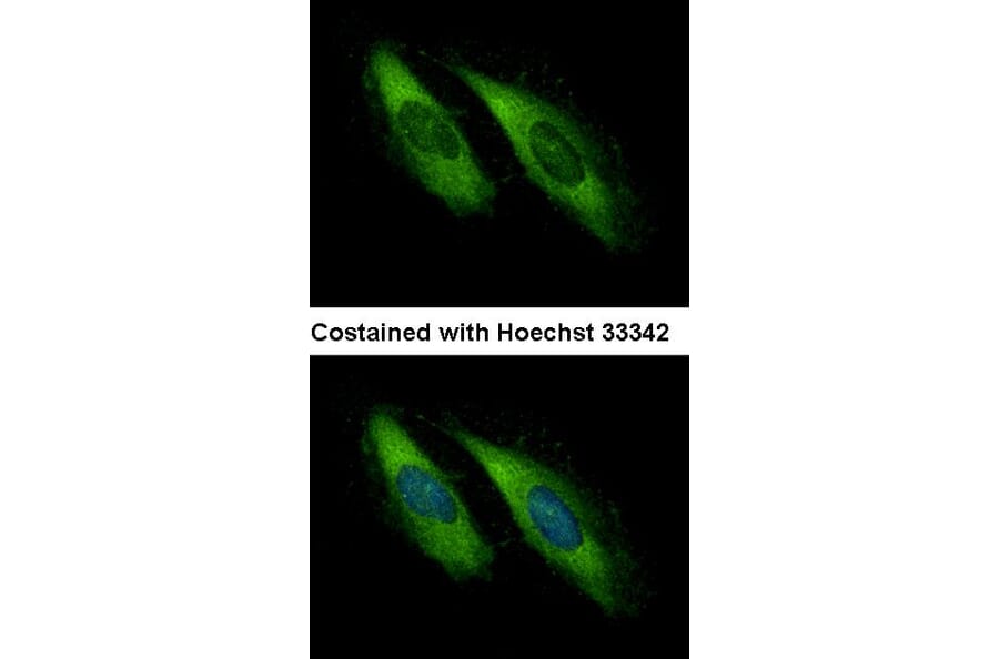 Immunofluorescence - UNC13D antibody from Signalway Antibody (22449) - Antibodies.com