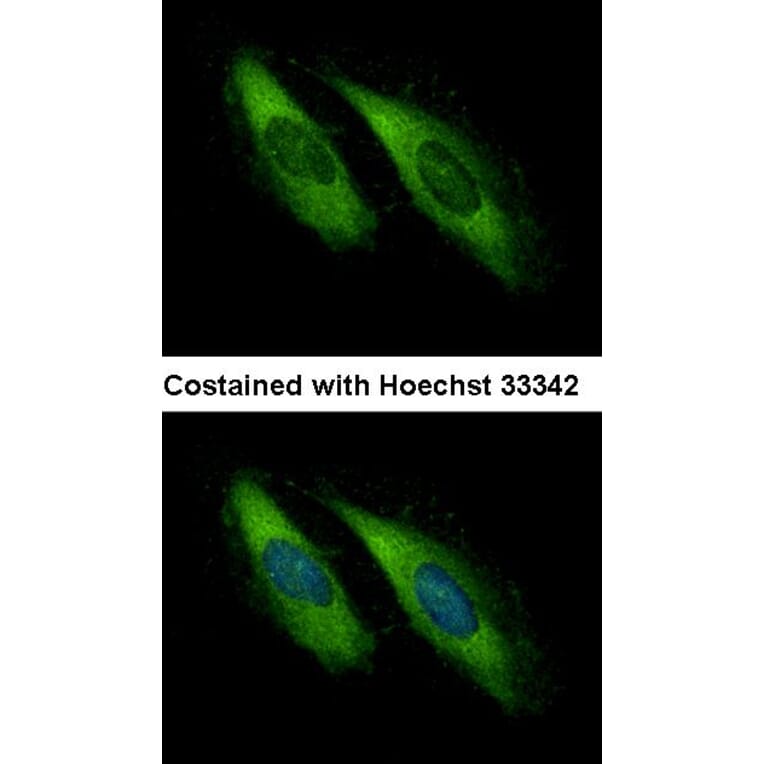 Immunofluorescence - UNC13D antibody from Signalway Antibody (22449) - Antibodies.com