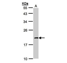 NDUFS4 antibody from Signalway Antibody (22560) - Antibodies.com