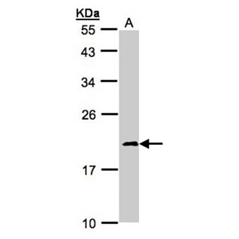 NDUFS4 antibody from Signalway Antibody (22560) - Antibodies.com