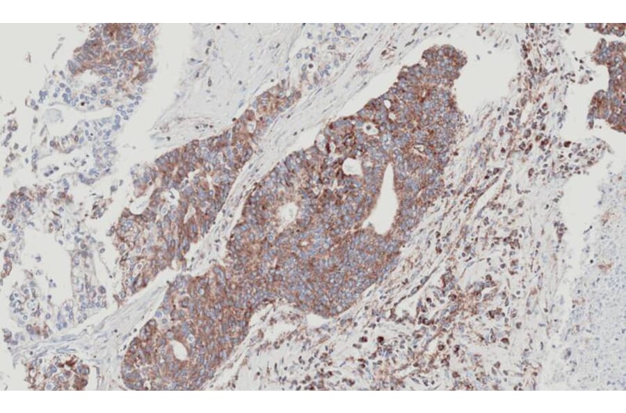Immunohistochemistry - NDUFS4 antibody from Signalway Antibody (22560) - Antibodies.com