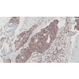 Immunohistochemistry - NDUFS4 antibody from Signalway Antibody (22560) - Antibodies.com