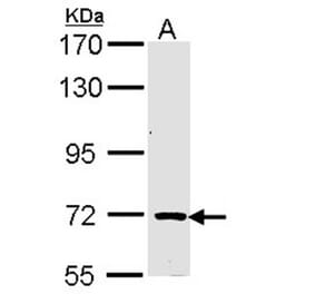 TRIM32 antibody from Signalway Antibody (22568) - Antibodies.com