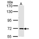 TRIM32 antibody from Signalway Antibody (22568) - Antibodies.com