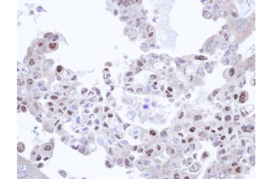 Immunohistochemistry - TRIM32 antibody from Signalway Antibody (22568) - Antibodies.com