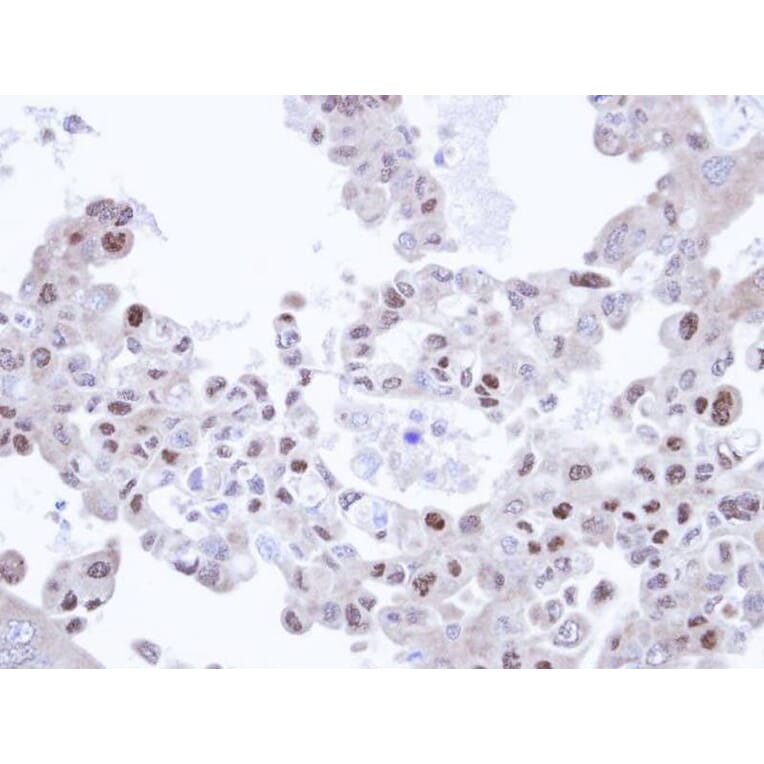 Immunohistochemistry - TRIM32 antibody from Signalway Antibody (22568) - Antibodies.com