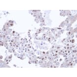 Immunohistochemistry - TRIM32 antibody from Signalway Antibody (22568) - Antibodies.com