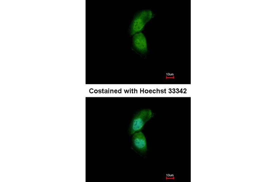Immunofluorescence - TRIM32 antibody from Signalway Antibody (22568) - Antibodies.com