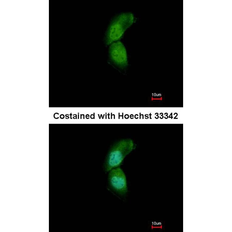 Immunofluorescence - TRIM32 antibody from Signalway Antibody (22568) - Antibodies.com