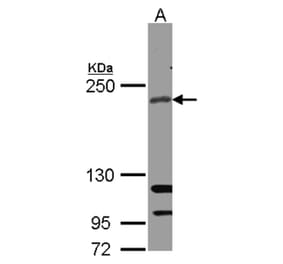 RICTOR antibody from Signalway Antibody (22594) - Antibodies.com