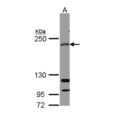 RICTOR antibody from Signalway Antibody (22594) - Antibodies.com