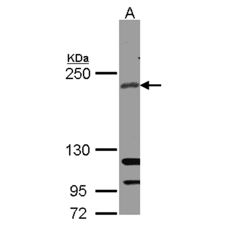 RICTOR antibody from Signalway Antibody (22594) - Antibodies.com