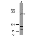 RICTOR antibody from Signalway Antibody (22594) - Antibodies.com