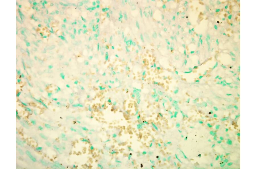 RICTOR antibody from Signalway Antibody (22594) - Antibodies.com