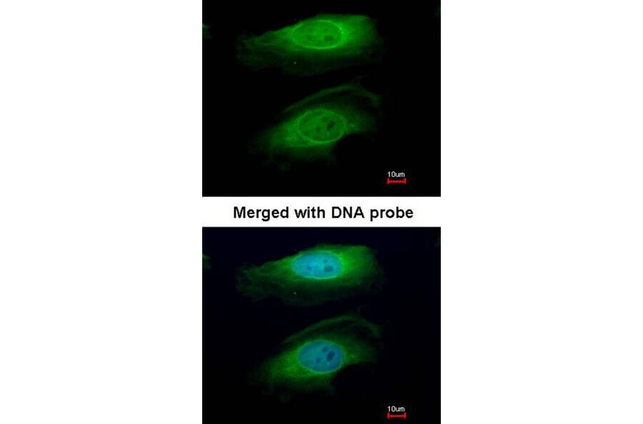 Immunofluorescence - RICTOR antibody from Signalway Antibody (22594) - Antibodies.com