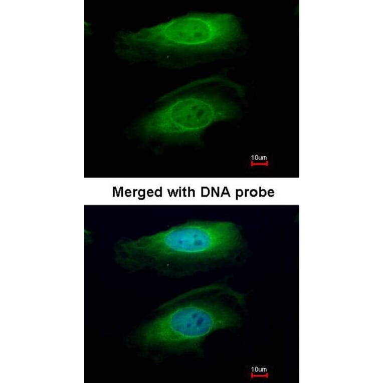 Immunofluorescence - RICTOR antibody from Signalway Antibody (22594) - Antibodies.com