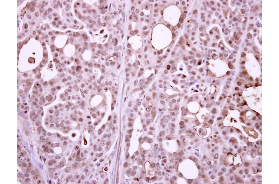 Immunohistochemistry - POLR2B antibody from Signalway Antibody (22649) - Antibodies.com
