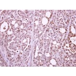 Immunohistochemistry - POLR2B antibody from Signalway Antibody (22649) - Antibodies.com