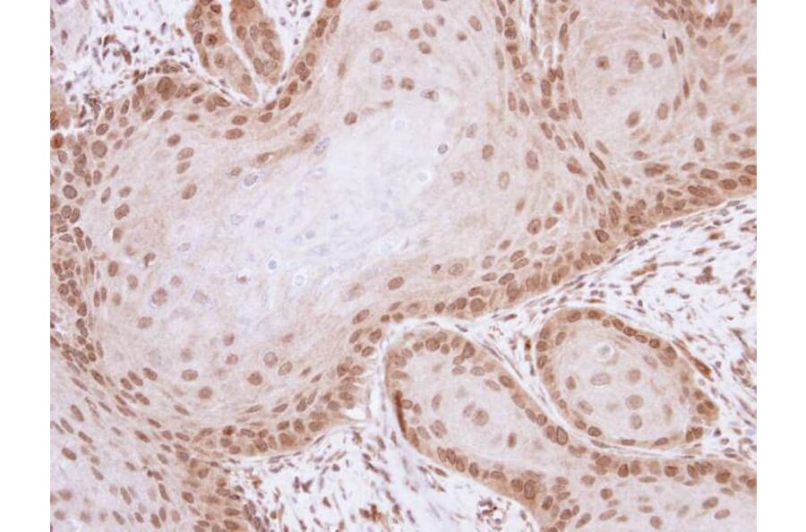 Immunohistochemistry - ML-IAP antibody from Signalway Antibody (22660) - Antibodies.com