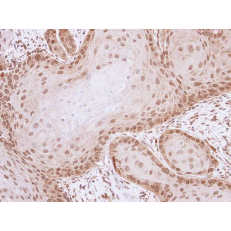 Immunohistochemistry - ML-IAP antibody from Signalway Antibody (22660) - Antibodies.com