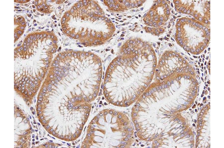 Immunohistochemistry - Dia 1 antibody from Signalway Antibody (22688) - Antibodies.com