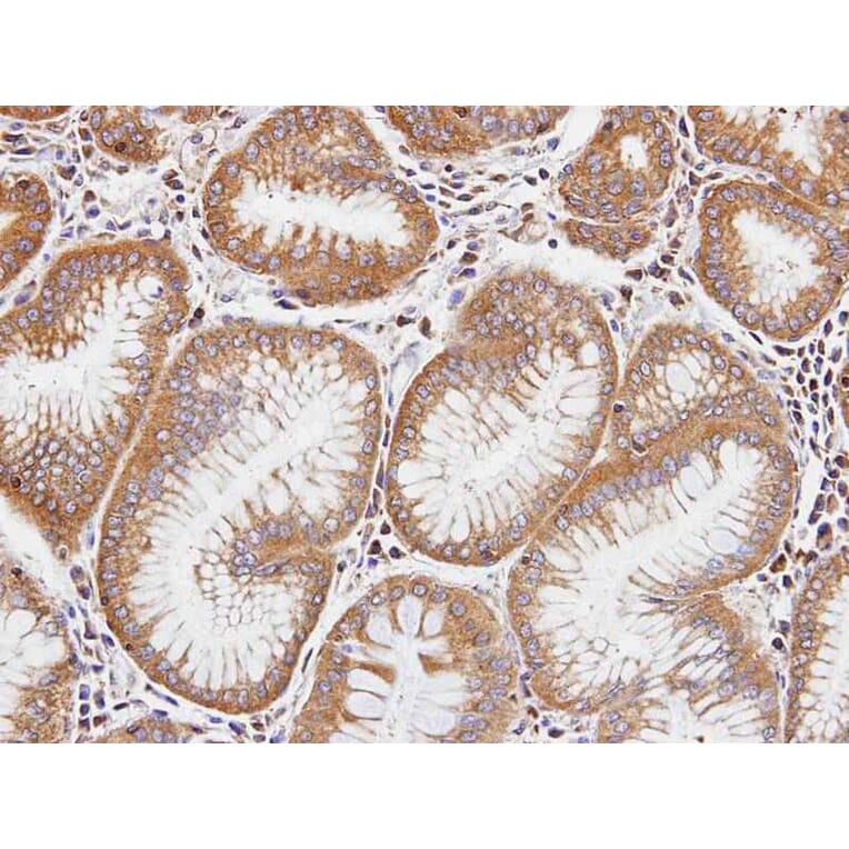 Immunohistochemistry - Dia 1 antibody from Signalway Antibody (22688) - Antibodies.com
