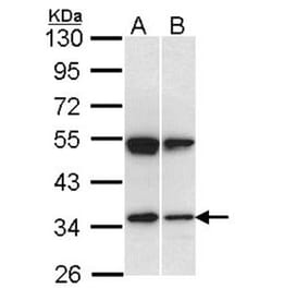 SH3GL1 antibody from Signalway Antibody (22759) - Antibodies.com