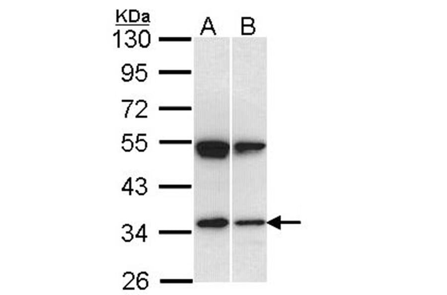 SH3GL1 antibody from Signalway Antibody (22759) - Antibodies.com