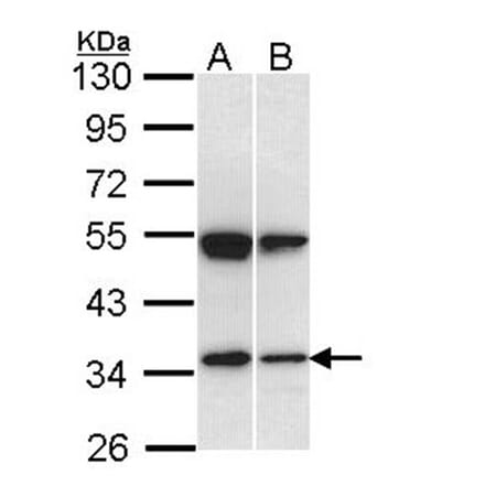 SH3GL1 antibody from Signalway Antibody (22759) - Antibodies.com