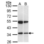 SH3GL1 antibody from Signalway Antibody (22759) - Antibodies.com