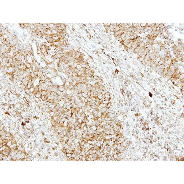 Immunohistochemistry - SH3GL1 antibody from Signalway Antibody (22759) - Antibodies.com