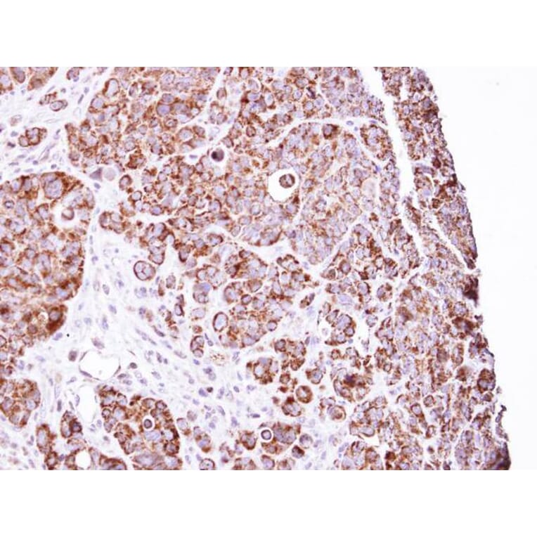 Immunohistochemistry - LRP130 antibody from Signalway Antibody (22766) - Antibodies.com