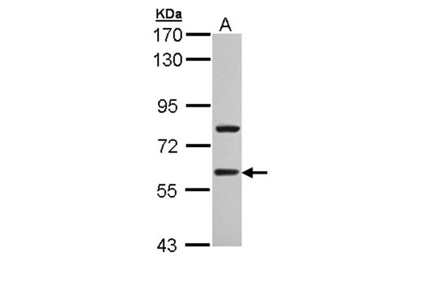 TBLR1 antibody from Signalway Antibody (22813) - Antibodies.com