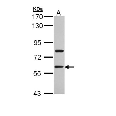 TBLR1 antibody from Signalway Antibody (22813) - Antibodies.com