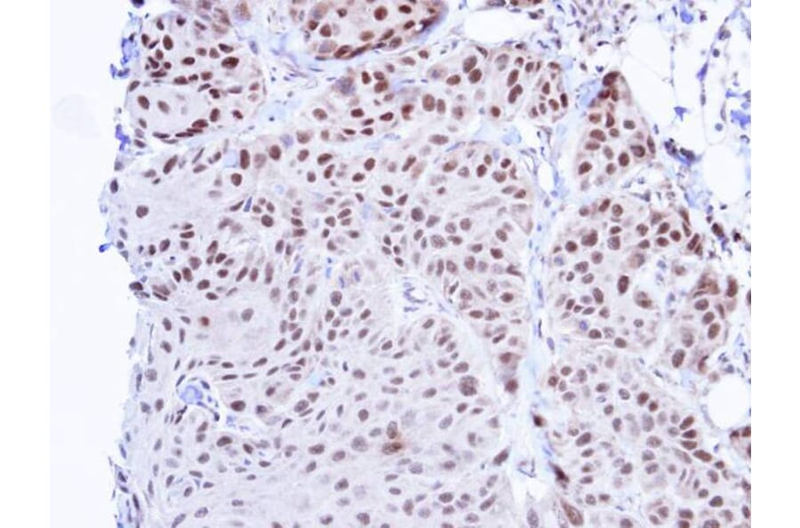 Immunohistochemistry - TBLR1 antibody from Signalway Antibody (22813) - Antibodies.com