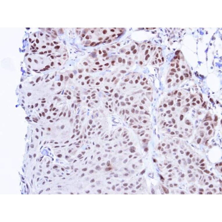 Immunohistochemistry - TBLR1 antibody from Signalway Antibody (22813) - Antibodies.com